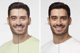 How To Correct Asymmetrical Faces: Face Correction Surgeries